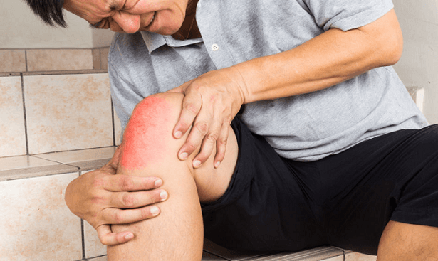 dolor y rigidez casa de reposo